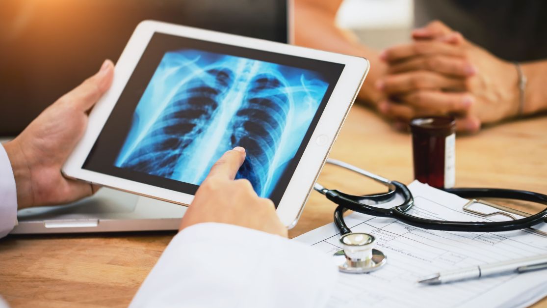 SRAG: quais vírus podem levar ao quadro que causou emergência?